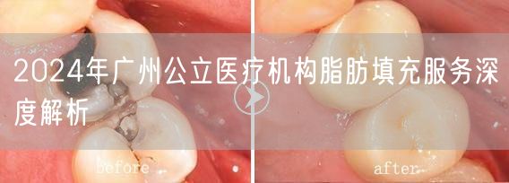2024年广州公立医疗机构脂肪填充服务深度解析