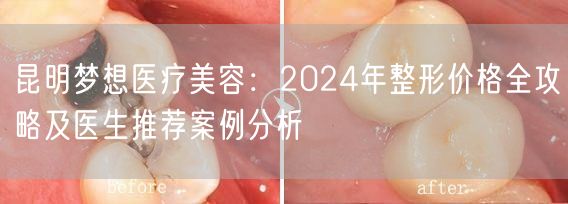昆明梦想医疗美容：2024年整形价格全攻略及医生推荐案例分析