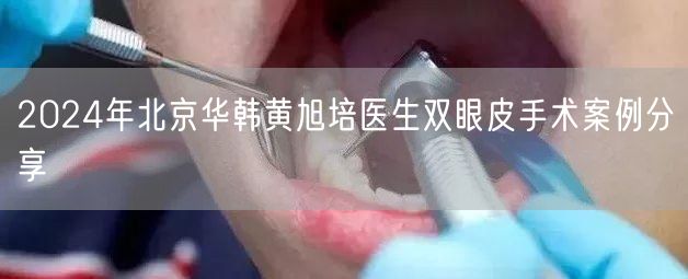 2024年北京华韩黄旭培医生双眼皮手术案例分享
