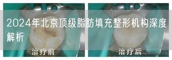 2024年北京顶级脂肪填充整形机构深度解析
