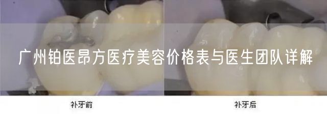 广州铂医昂方医疗美容价格表与医生团队详解