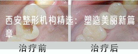 西安整形机构精选：塑造美丽新篇章