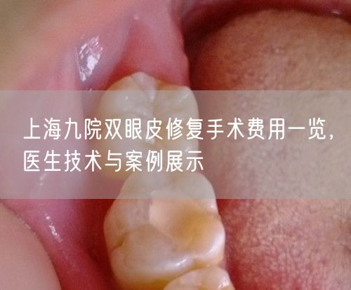 上海九院双眼皮修复手术费用一览，医生技术与案例展示
