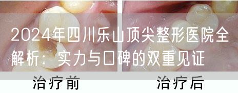 2024年四川乐山顶尖整形医院全解析：实力与口碑的双重见证