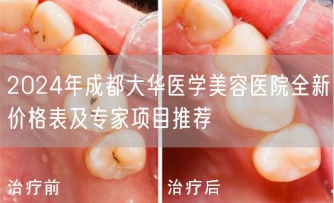 2024年成都大华医学美容医院全新价格表及专家项目推荐