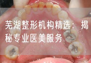 芜湖整形机构精选：揭秘专业医美服务