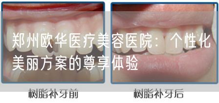 郑州欧华医疗美容医院：个性化美丽方案的尊享体验