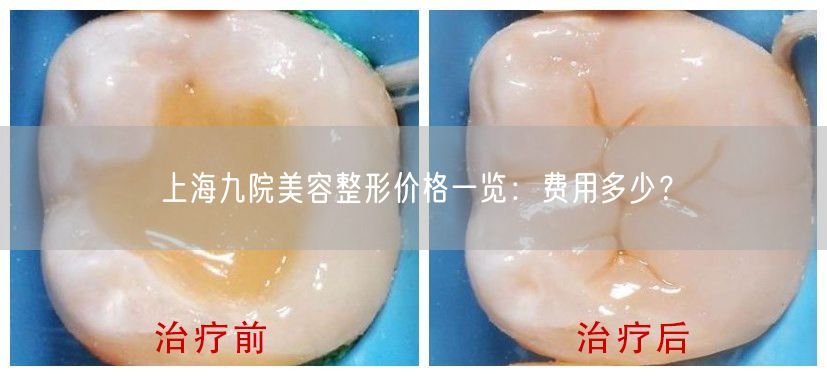 上海九院美容整形价格一览：费用多少？