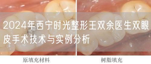 2024年西宁时光整形王双余医生双眼皮手术技术与实例分析