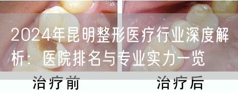 2024年昆明整形医疗行业深度解析：医院排名与专业实力一览