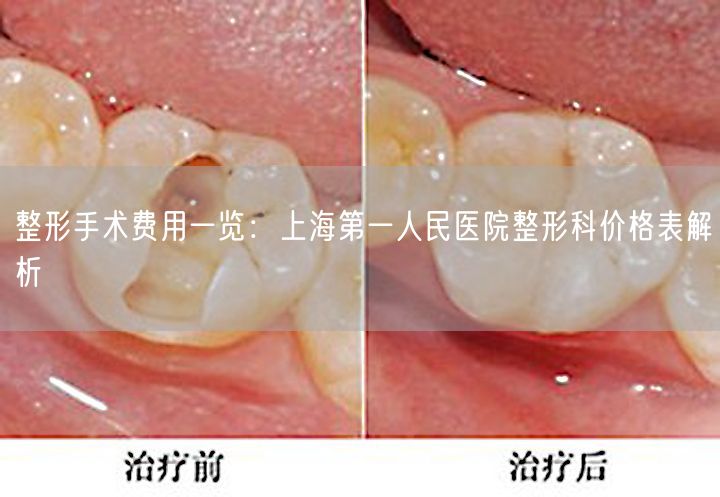 整形手术费用一览：上海第一人民医院整形科价格表解析