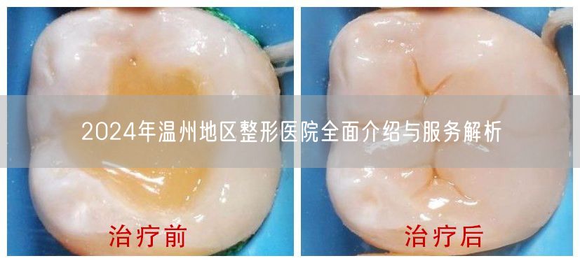 2024年温州地区整形医院全面介绍与服务解析