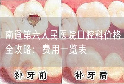 南通第六人民医院口腔科价格全攻略：费用一览表