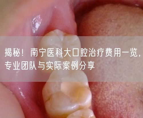 揭秘！南宁医科大口腔治疗费用一览，专业团队与实际案例分享