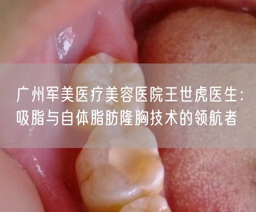 广州军美医疗美容医院王世虎医生：吸脂与自体脂肪隆胸技术的领航者