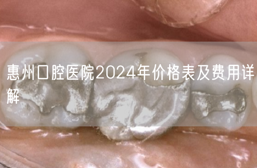 惠州口腔医院2024年价格表及费用详解
