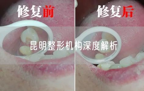 昆明整形机构深度解析