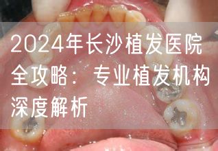 2024年长沙植发医院全攻略：专业植发机构深度解析