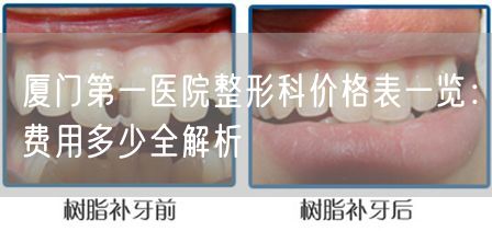 厦门第一医院整形科价格表一览：费用多少全解析