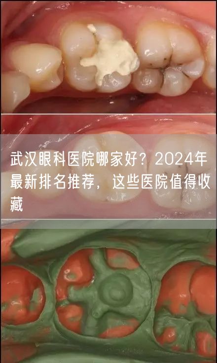 武汉眼科医院哪家好？2024年最新排名推荐，这些医院值得收藏