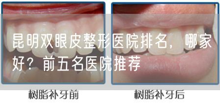 昆明双眼皮整形医院排名，哪家好？前五名医院推荐