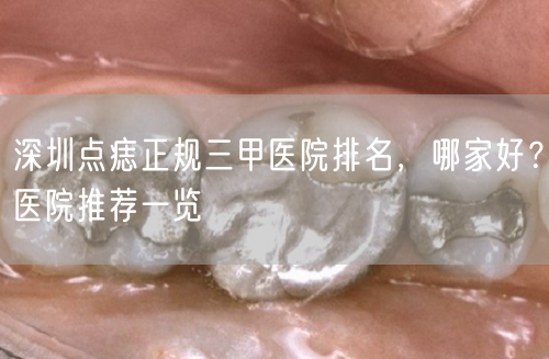 深圳点痣正规三甲医院排名，哪家好？医院推荐一览