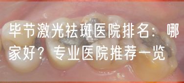 毕节激光祛斑医院排名：哪家好？专业医院推荐一览