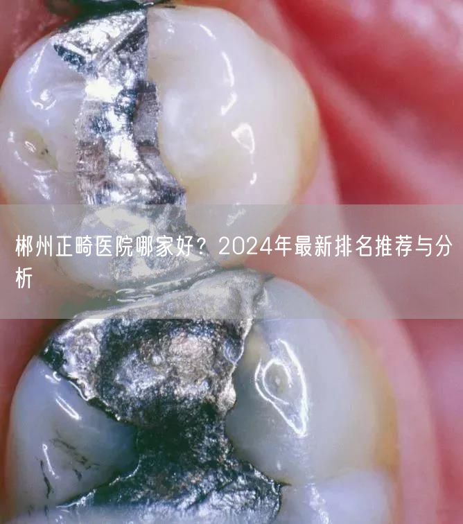 郴州正畸医院哪家好？2024年最新排名推荐与分析
