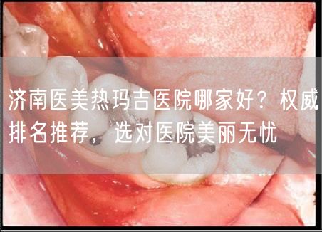 济南医美热玛吉医院哪家好？权威排名推荐，选对医院美丽无忧