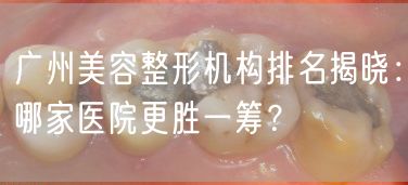 广州美容整形机构排名揭晓：哪家医院更胜一筹？