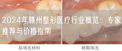 2024年赣州整形医疗行业概览：专家推荐与价格指南