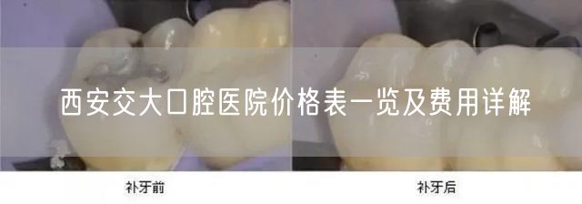 西安交大口腔医院价格表一览及费用详解