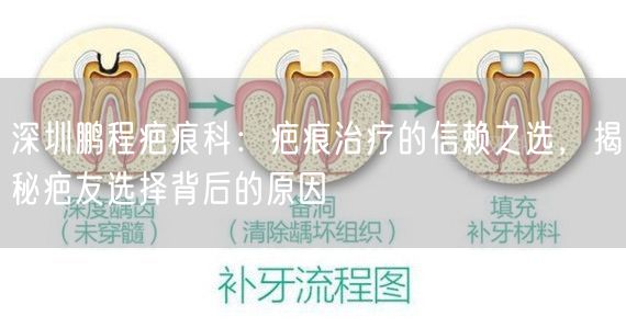 深圳鹏程疤痕科：疤痕治疗的信赖之选，揭秘疤友选择背后的原因