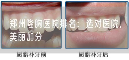 郑州隆胸医院排名：选对医院，美丽加分