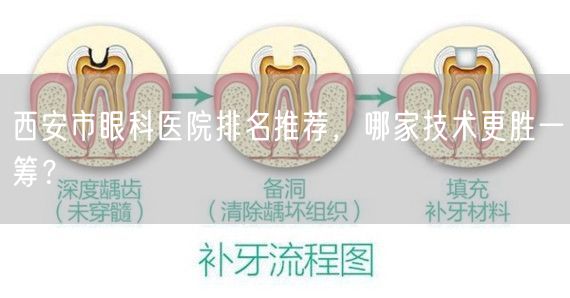 西安市眼科医院排名推荐，哪家技术更胜一筹？