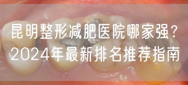 昆明整形减肥医院哪家强？2024年最新排名推荐指南