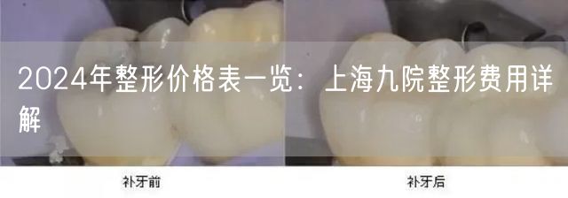 2024年整形价格表一览：上海九院整形费用详解