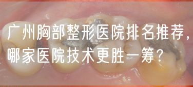 广州胸部整形医院排名推荐，哪家医院技术更胜一筹？