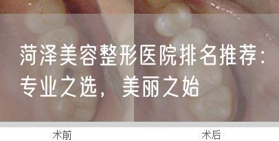 菏泽美容整形医院排名推荐：专业之选，美丽之始