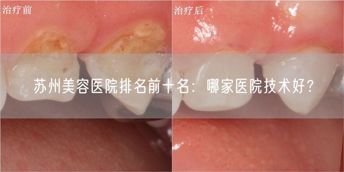 苏州美容医院排名前十名：哪家医院技术好？