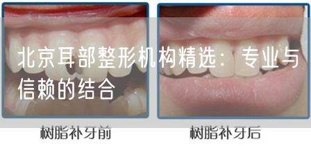 北京耳部整形机构精选：专业与信赖的结合