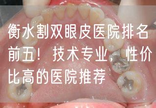 衡水割双眼皮医院排名前五！技术专业，性价比高的医院推荐