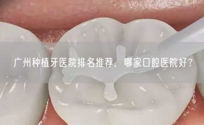 广州种植牙医院排名推荐，哪家口腔医院好？