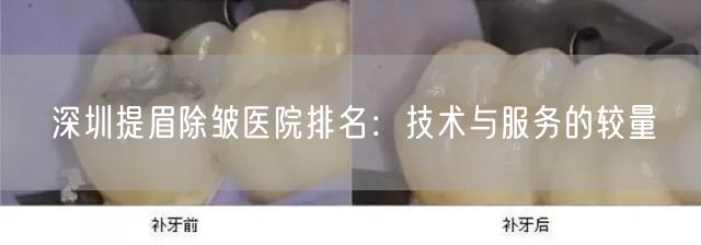 深圳提眉除皱医院排名：技术与服务的较量