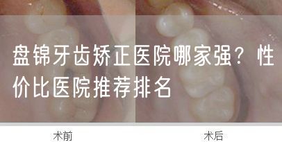 盘锦牙齿矫正医院哪家强？性价比医院推荐排名