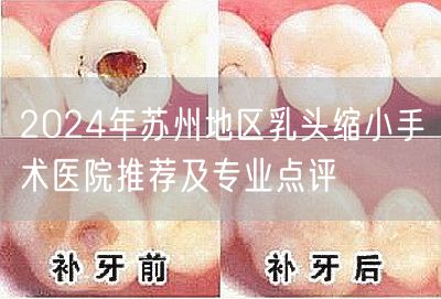 2024年苏州地区乳头缩小手术医院推荐及专业点评