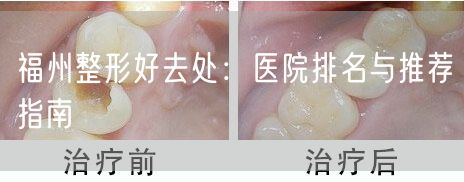 福州整形好去处：医院排名与推荐指南