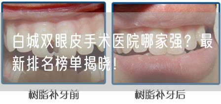 白城双眼皮手术医院哪家强？最新排名榜单揭晓！