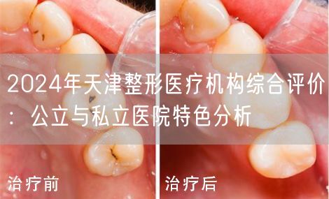 2024年天津整形医疗机构综合评价：公立与私立医院特色分析