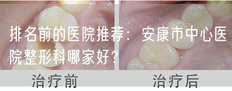 排名前的医院推荐：安康市中心医院整形科哪家好？